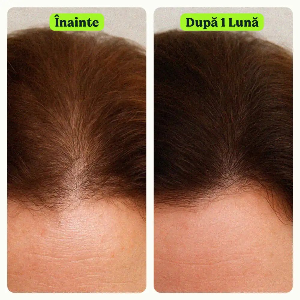 (SET) ȘAMPON 1 LITRU + ELIXIR PĂR 5 în 1 - prindetop