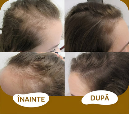 Ser Arăbesc cu Biotină | 1+1 GRATIS - prindetop